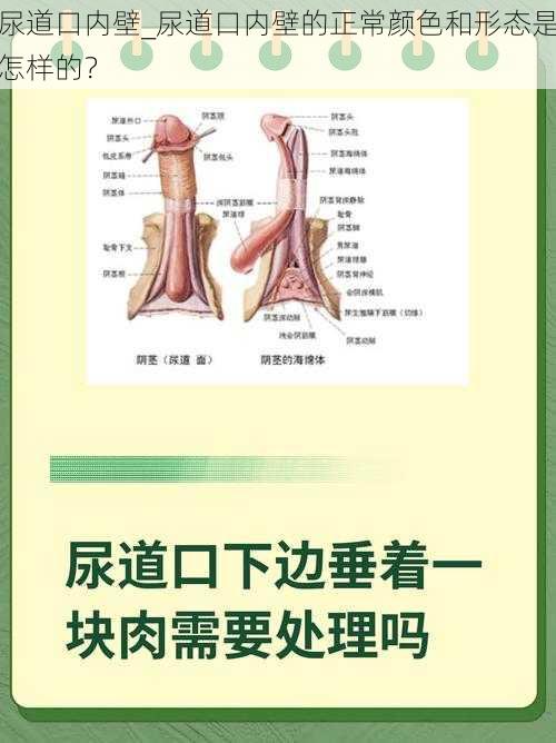 尿道口内壁_尿道口内壁的正常颜色和形态是怎样的?