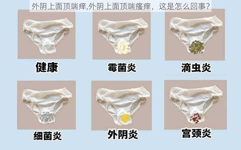 外阴上面顶端痒,外阴上面顶端瘙痒,这是怎么回事?